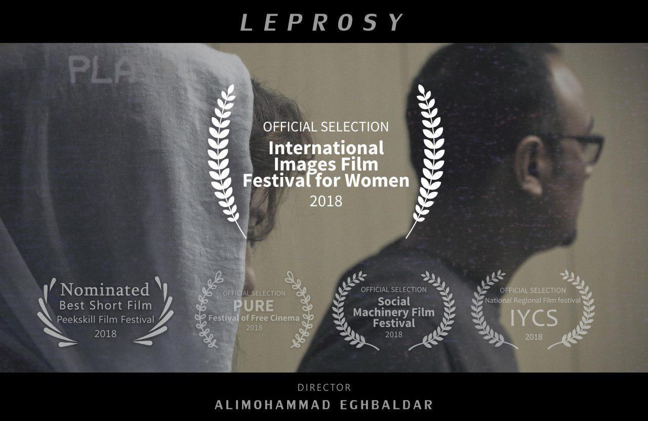 چهارمین حضور بین المللی فیلم کوتاه «جذام» به کارگردانی علیمحمد اقبالدار در Zimbabwe