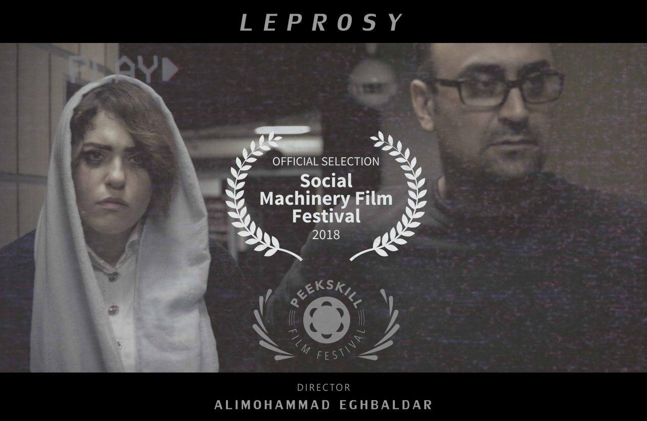 دومین حضور بین المللی فیلم کوتاه «جذام» به کارگردانی علیمحمد اقبالدار